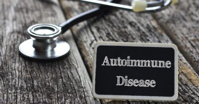 How Autoimmune Conditions Affect Skin Hair